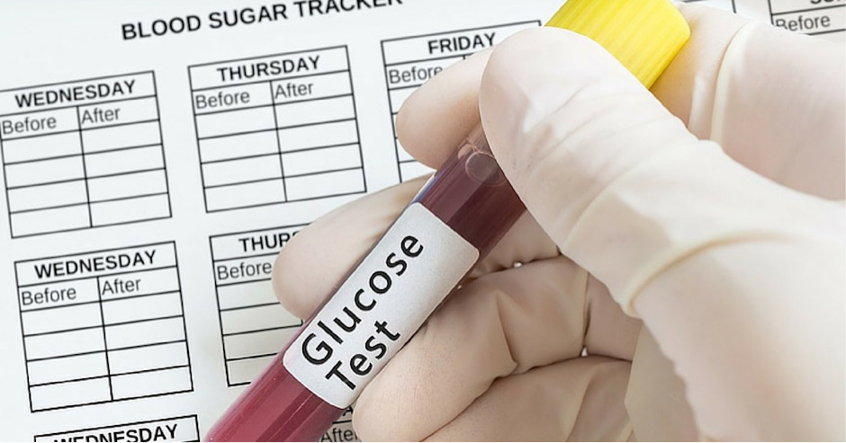 Glucose Test