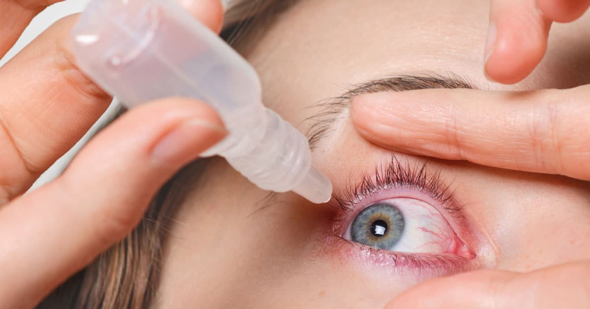 Symptoms, Causes And Treatment For Conjunctivitis